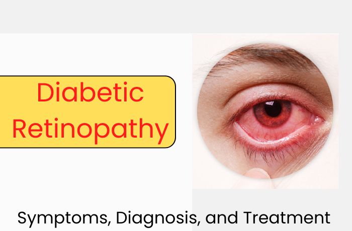 Diabetic Retinopathy: Symptoms, Diagnosis, and Treatment